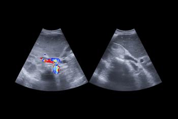 bile duct cancer © samunella - stock.adobe.com