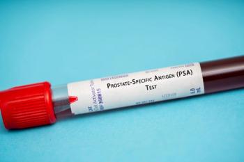 test tube on turquoise background with label that says prostatic-specific antigen  | ©luchschenF