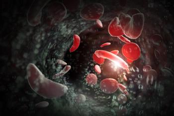 Sickle cell anemia illustration | Image credits: @Ezume Images stock.adobe.com
