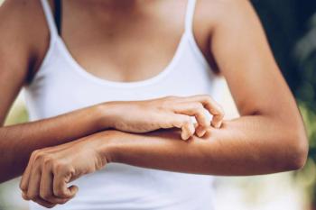 women scratching her left arm with her right hand | ©anut1ng stock.adobe.com