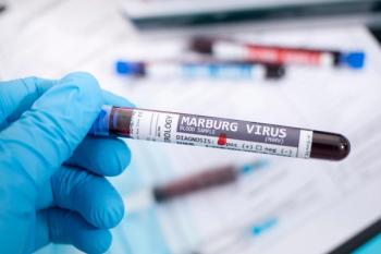 test tube with Marburg virus written on it | ©mauro rodrigues stock.adobe.com
