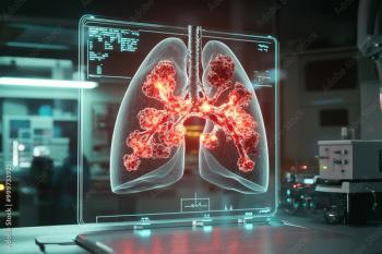 Image of lung cancer |image credit: @See More stock.adobe.com