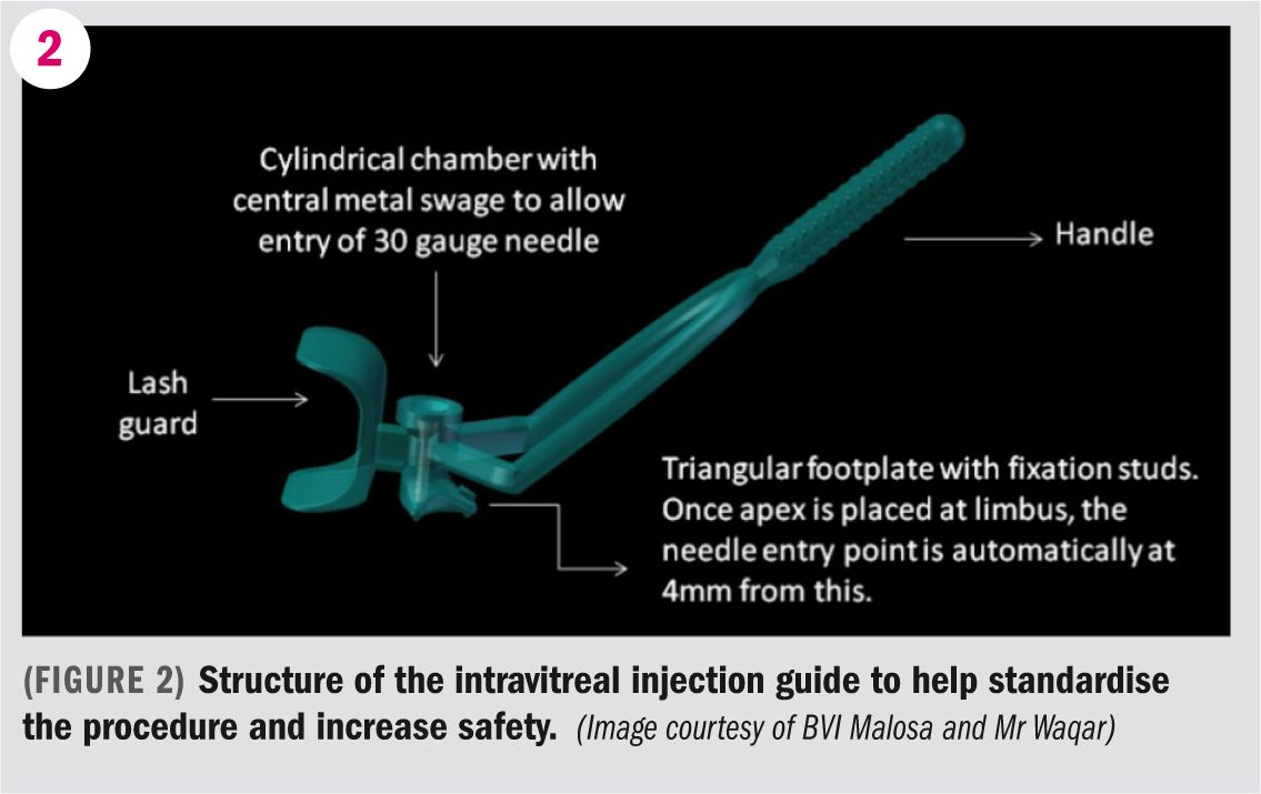 Improving the accuracy and comfort of intravitreal injections