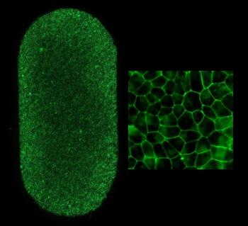 First US patient with dry AMD dosed with autologous stem cell therapy