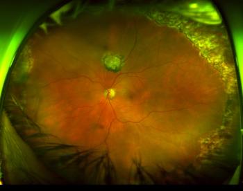 Ultra-widefield imaging can enhance efficiency for practices