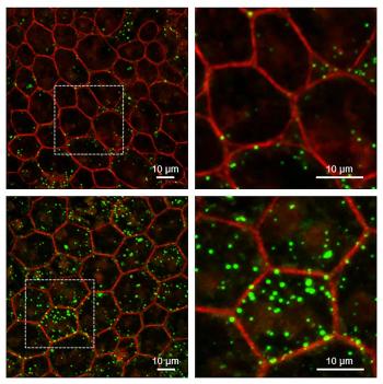 Loss of "youth" protein may drive aging in the eye, NEI study finds