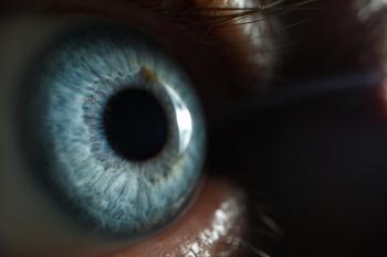 retina, glaucoma disease monitoring