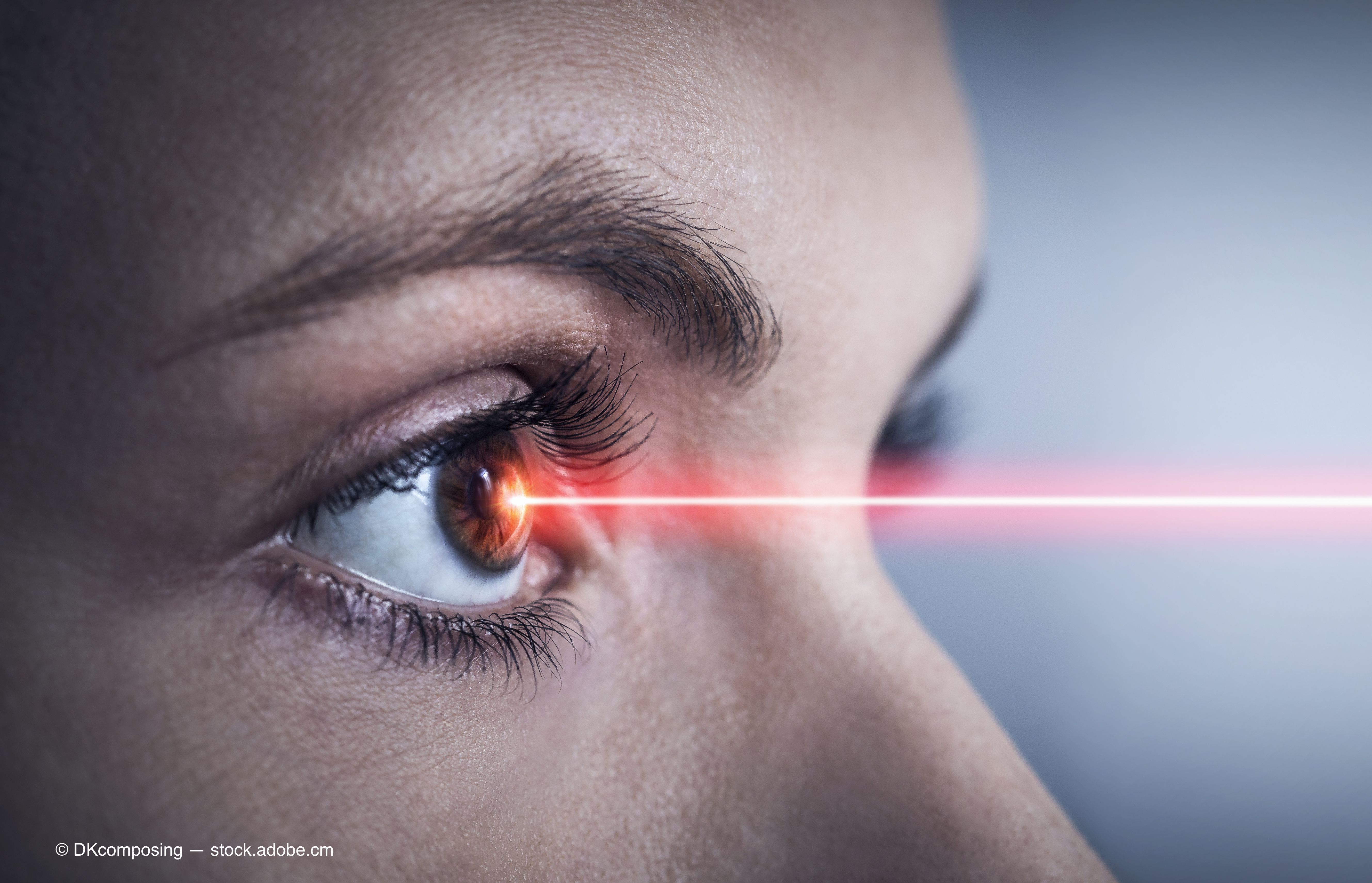Subthreshold laser may reduce intravitreal injections for DME