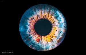 Norway first in world to deploy autonomous AI eye screening technology on national scale