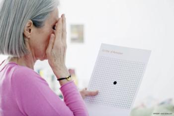 Encapsulated cell technology delivery of ciliary neurotrophic factor: promising treatment for macular telangiectasia type 2