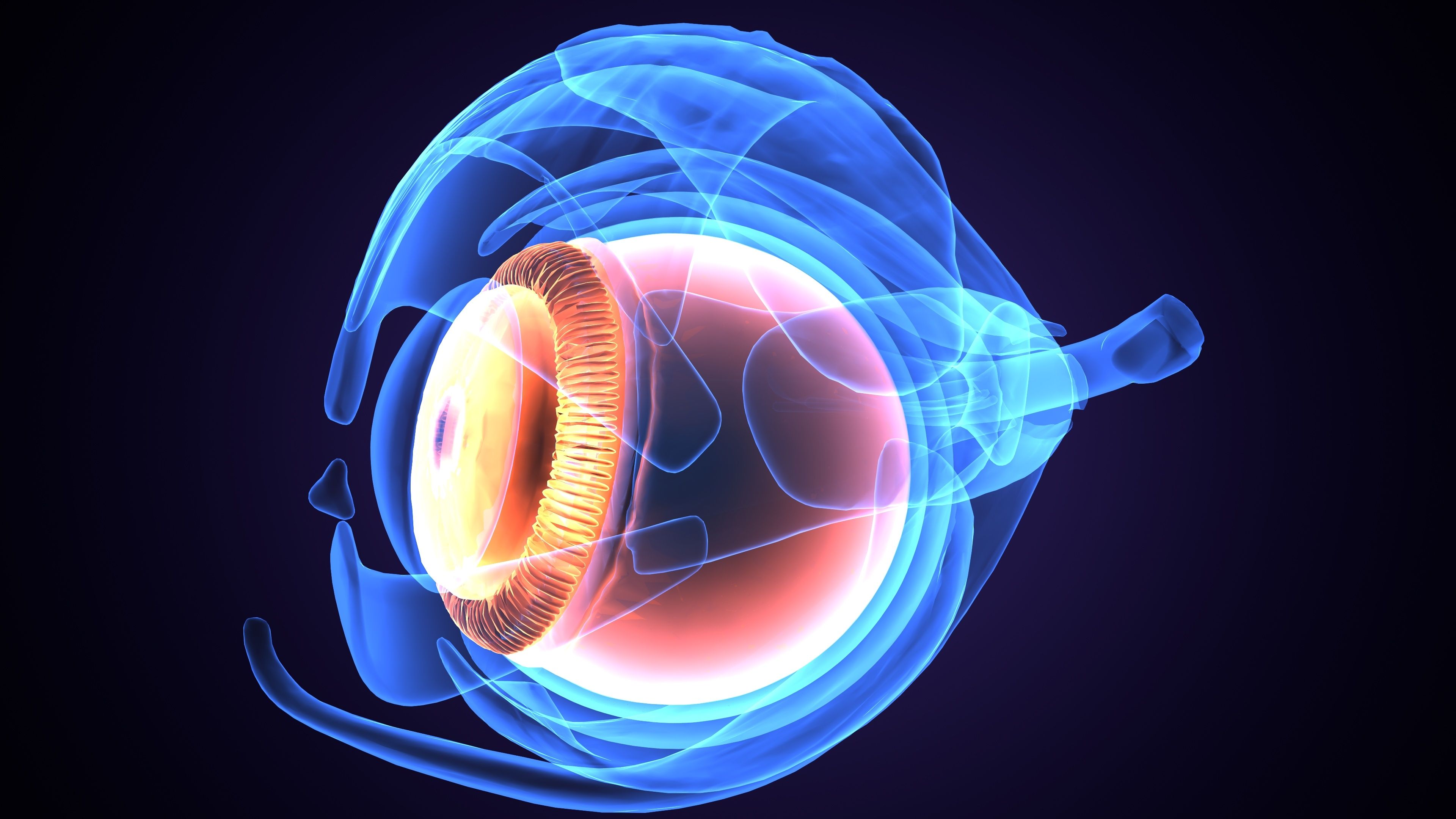 ADVM-022: Sustained anatomic improvements for wet AMD