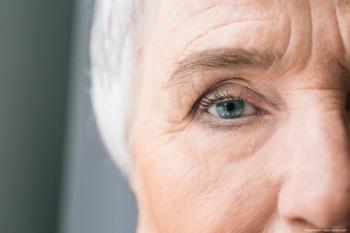 Distinguishing between MS and neuromyelitis optica with optic neuritis