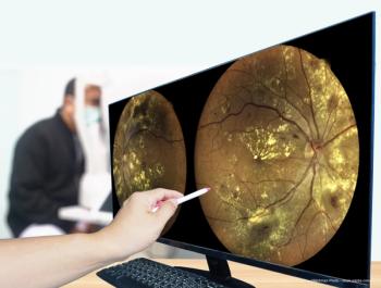 Glaucoma conversion predictor proves faster, cheaper than alternatives