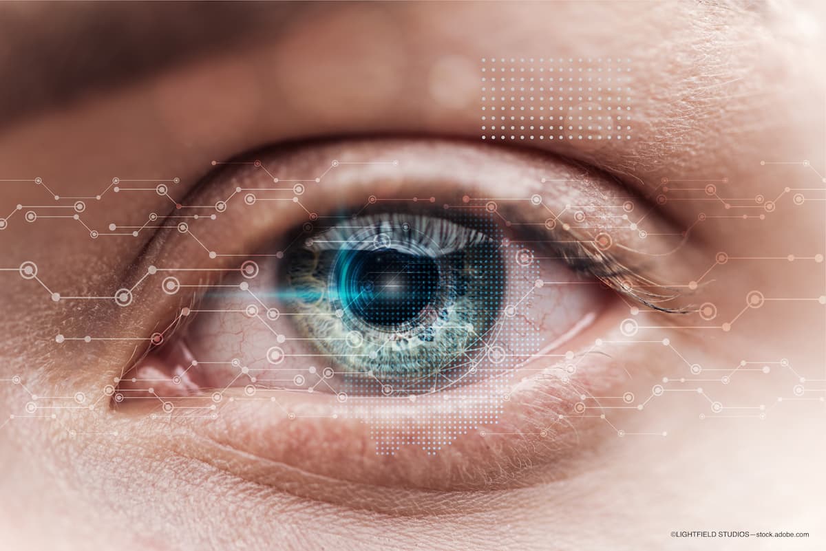 PALADIN 3-year results: Fluocinolone acetonide intravitreal implant improves visual acuity, CST