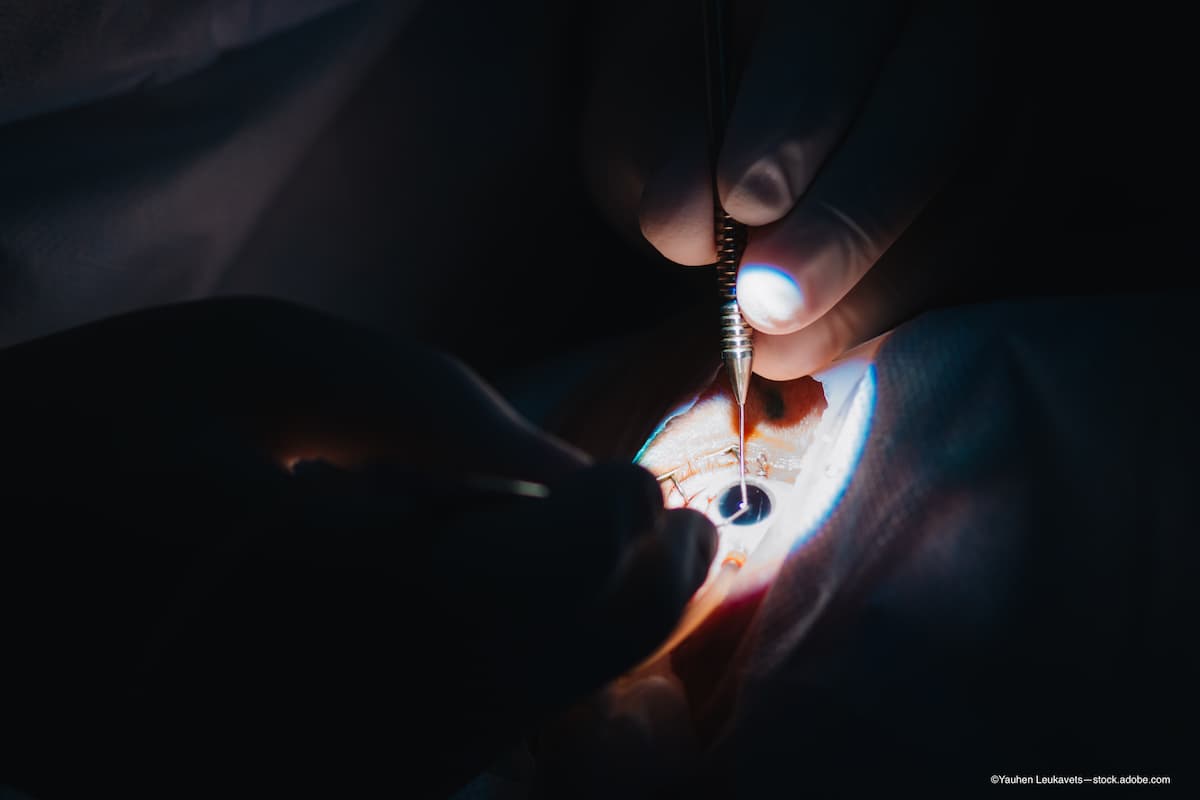Acute retinal necrosis: Retinal detachment rates are unaffected by early treatment with intravitreal antivirals, vitrectomy 