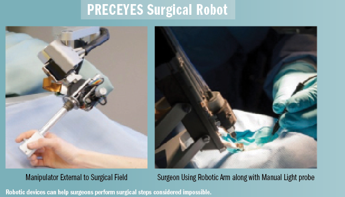 preceyes surgical robot