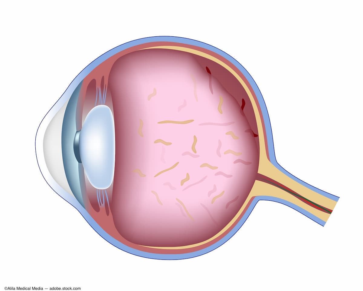 Image credit: ©Alila Medical Media – stock.adobe.com