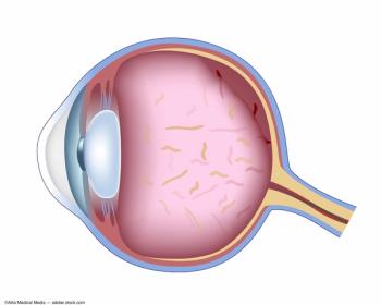 Image credit: ©Alila Medical Media – stock.adobe.com