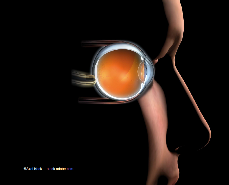 PDS maintains visual, anatomic benefits over long term in Portal extension trial