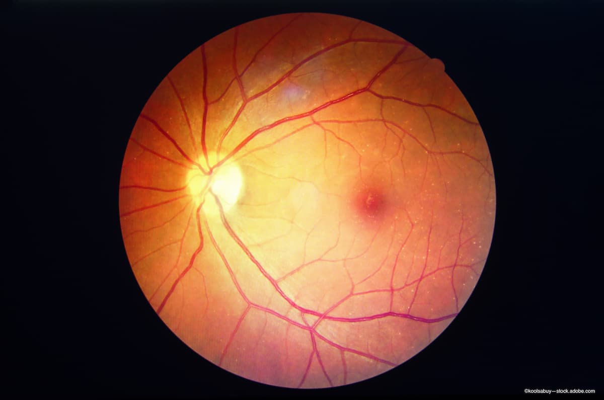 This week in retina: April 15-April 21