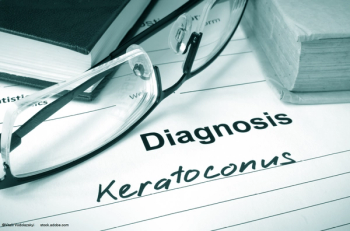 Crosslinking for Children with Keratoconus