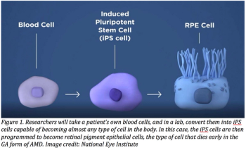 Blood cells to iPS