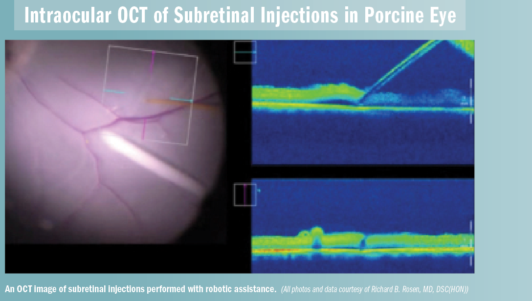 Robotics allow surgeons to perform the seemingly impossible