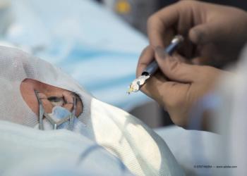 New drug application filed for pegcetacoplan for the treatment of geographic atrophy