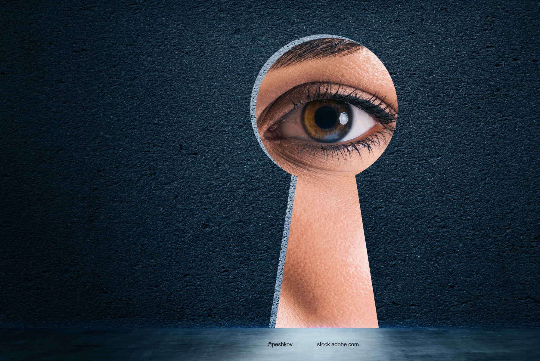 Unraveling the mystery of DME outcomes