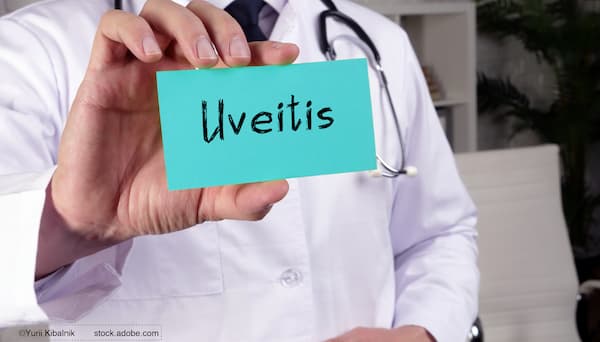 (Image credit: AdobeStock/Yurii Kibalnik) Retina World Congress 2026: Uveitis risk rises as immune checkpoint inhibitor use expands