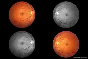 Gaining a greater understanding of AMD