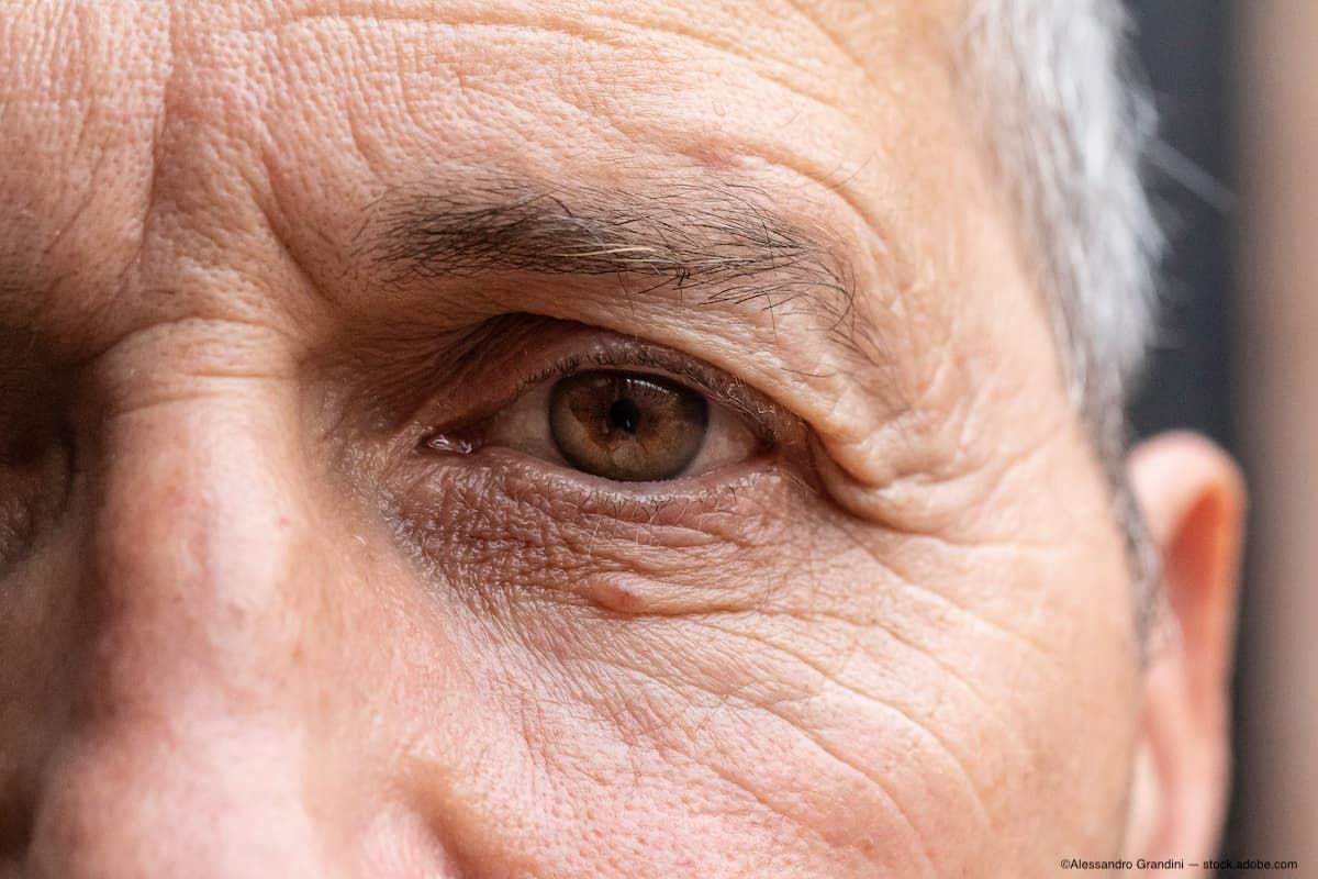 ©Alessandro Grandini / stock.adobe.com