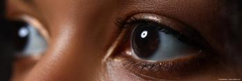 Outlook Therapeutics approaching FDA approval of bevacizumab-vikg for wet AMD treatment