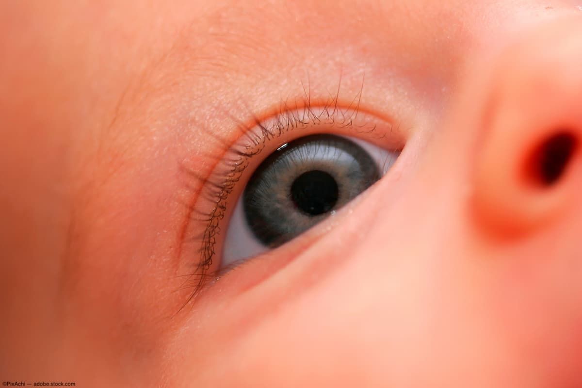 Image credit: ©PixAchi – stock.adobe.com