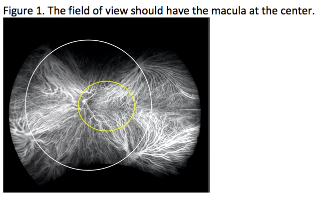 Widefield imaging angiography fluorescein Coming to terms with ‘ultra-widefield’ and ‘widefield’ imaging