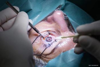 Assessing changes in retina over time following uncomplicated cataract extraction