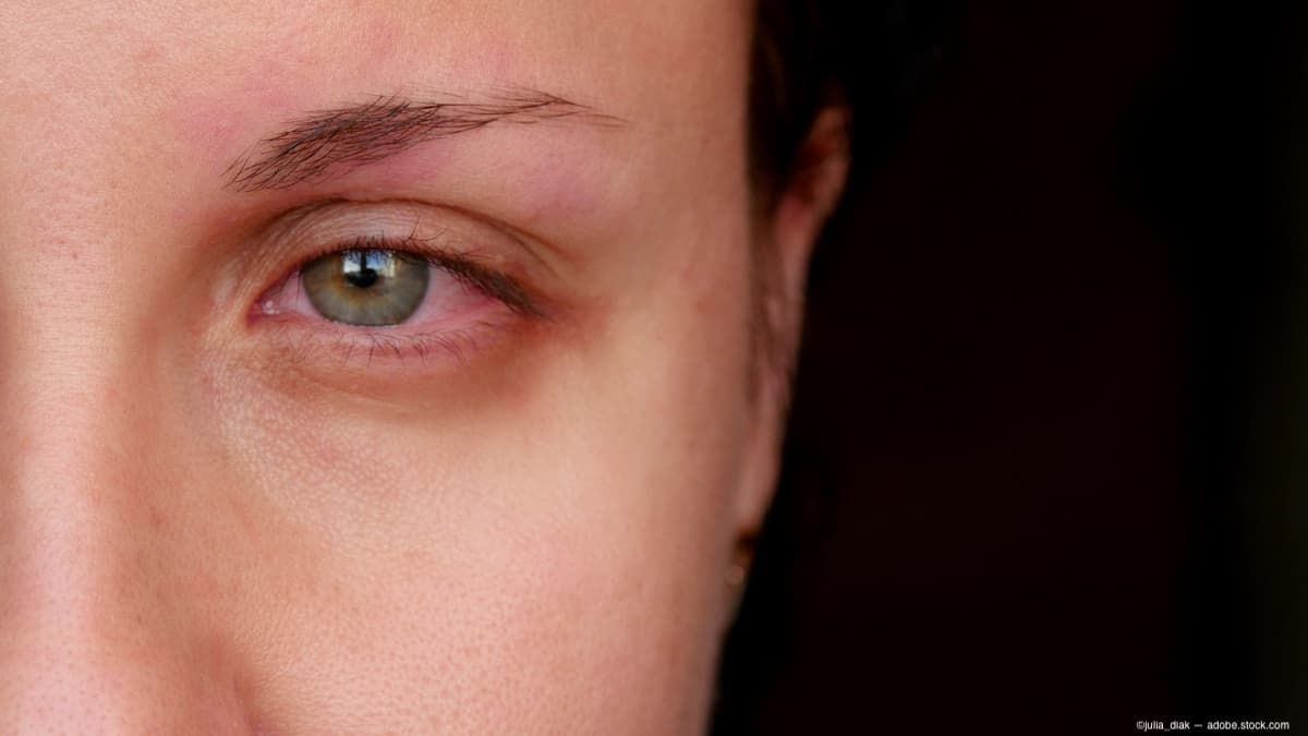 Image Credit: ©julia_diak - stock.adobe.com