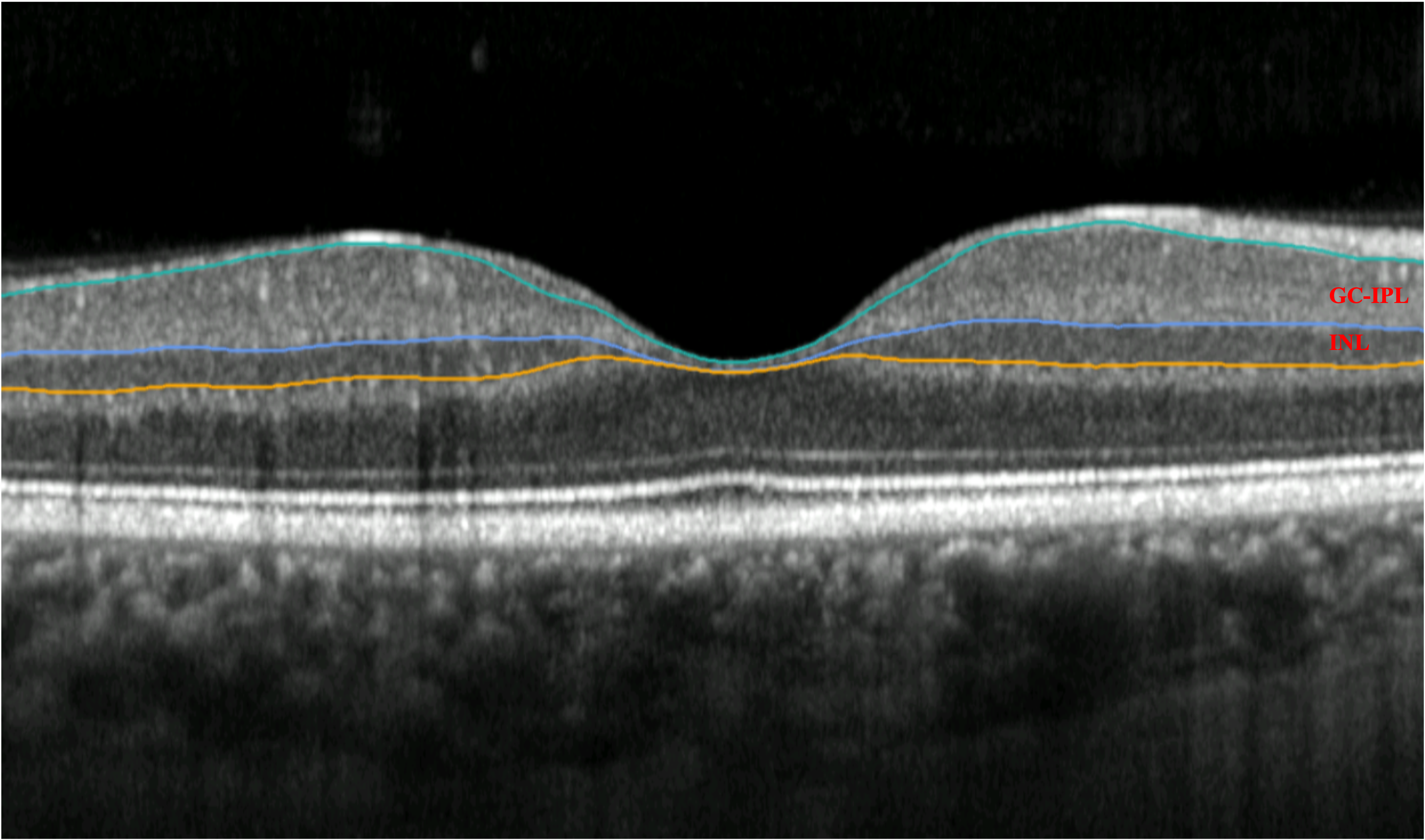 Image courtesy of the researchers