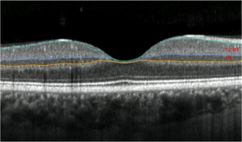 Image courtesy of the researchers