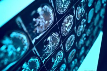 UPLIZNA safe, effective for patients with neuromyelitis optica spectrum disorder