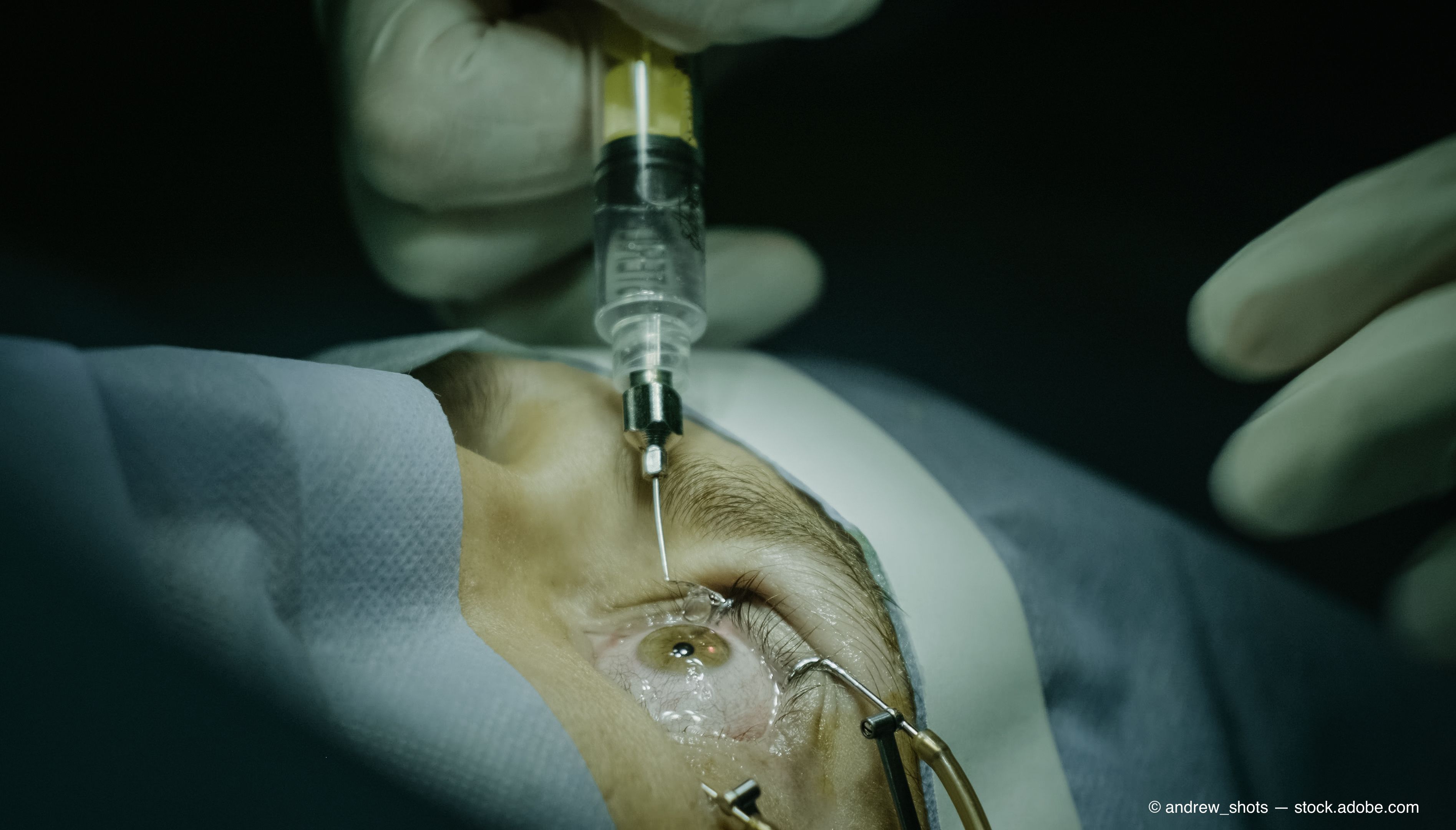 Retina Injection Protocol This week in retina: April 8-14
