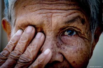 Emerging treatments for advanced dry AMD