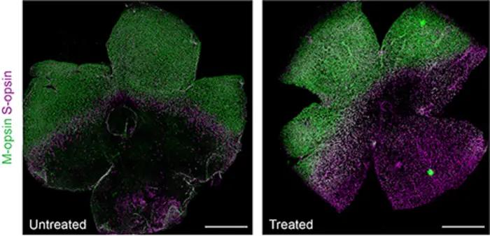 UCI study cites base editing as a durable one-time treatment for inherited retinal degeneration