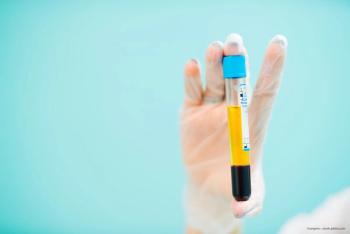 Plasma metabolomic profiles linked with AMD progression