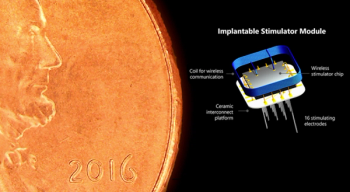 First successful implantation of wireless visual prosthesis brain implant completed