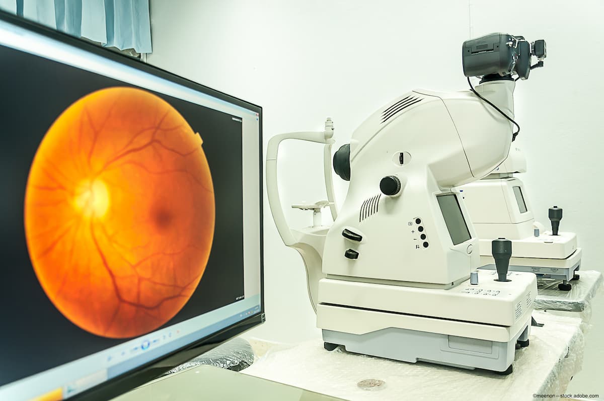 Difference in retinal age and real age linked to increased death risk