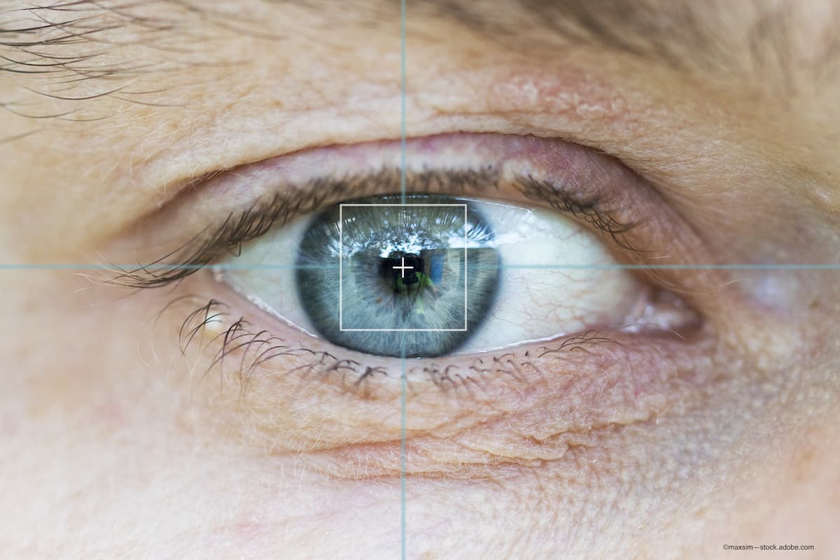 Wet AMD home monitoring systems provide high-quality scans