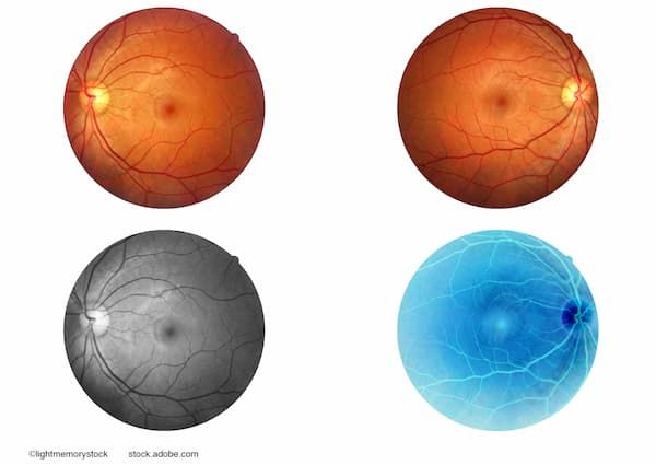 (Image credit: AdobeStock/lightmemorystock)