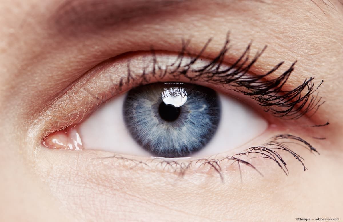 Image credit: ©Stasique – stock.adobe.com