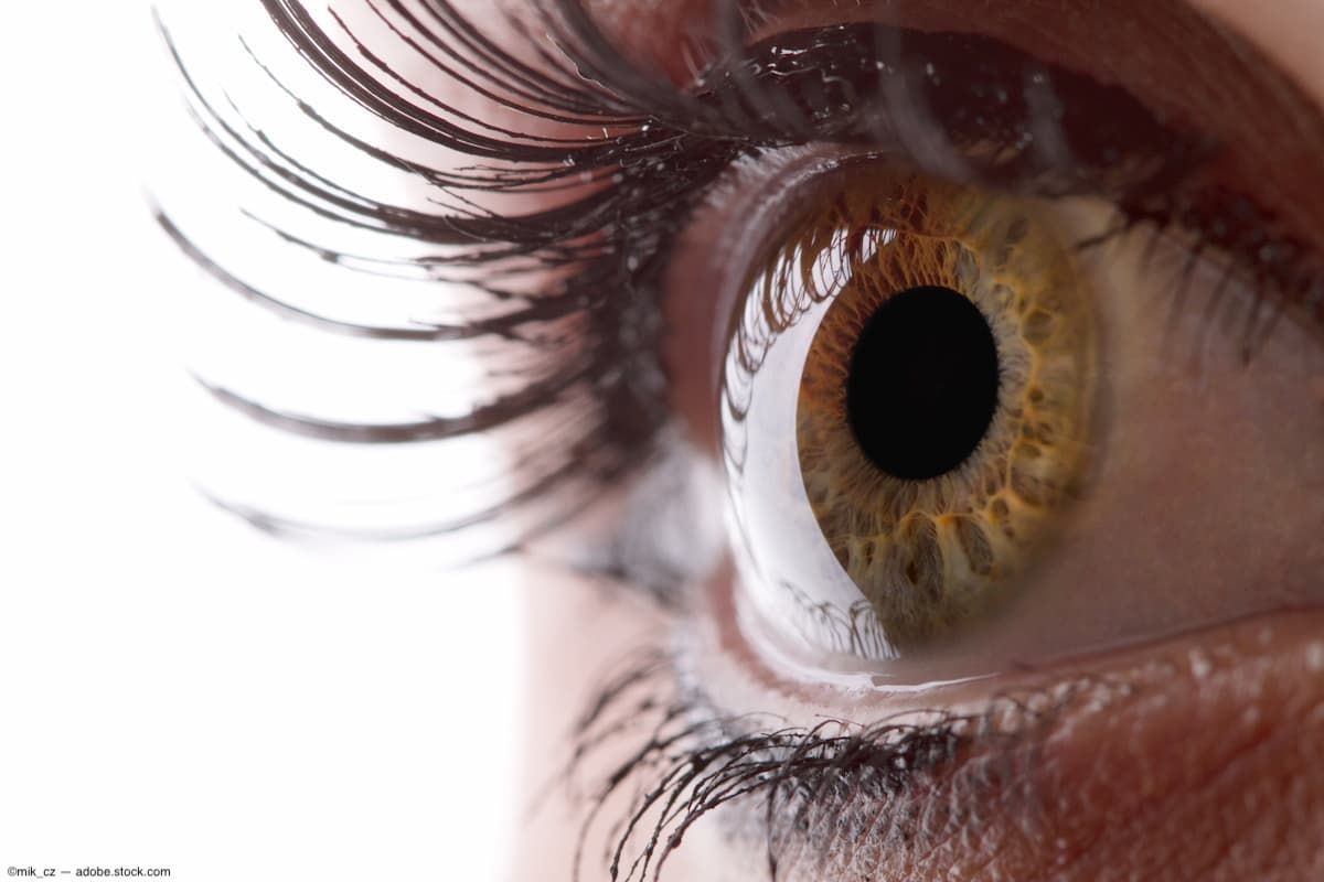 Optos marks 25,000 devices installed globally